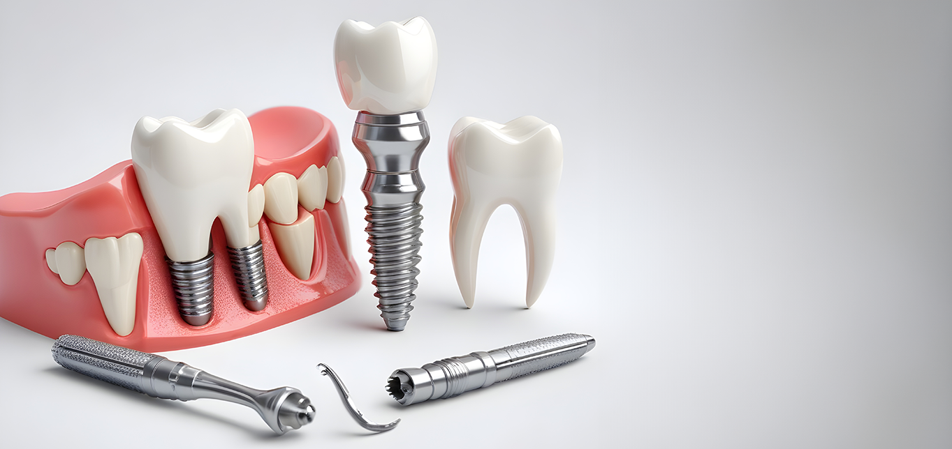 dental-implant-types-treatment-and-recovery-guide