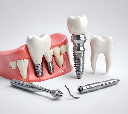 dental-implant-types-treatment-and-recovery-guide