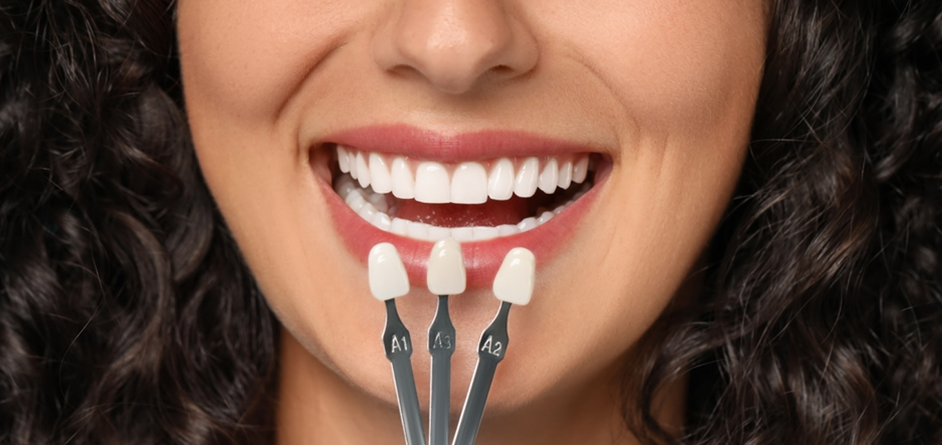 how-veneers-can-fix-gaps-stains-and-imperfections-in-your-teeth