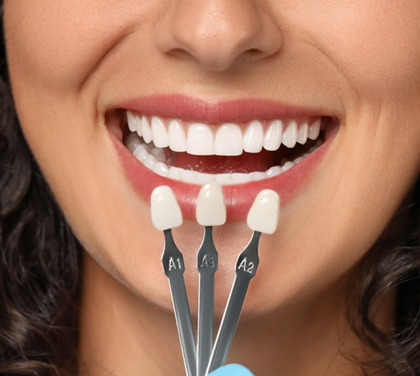 how-veneers-can-fix-gaps-stains-and-imperfections-in-your-teeth