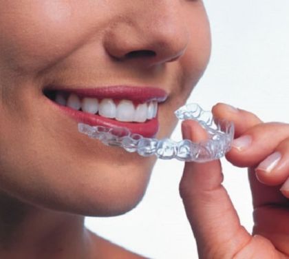 pieces-of-advice-when-wearing-dental-braces