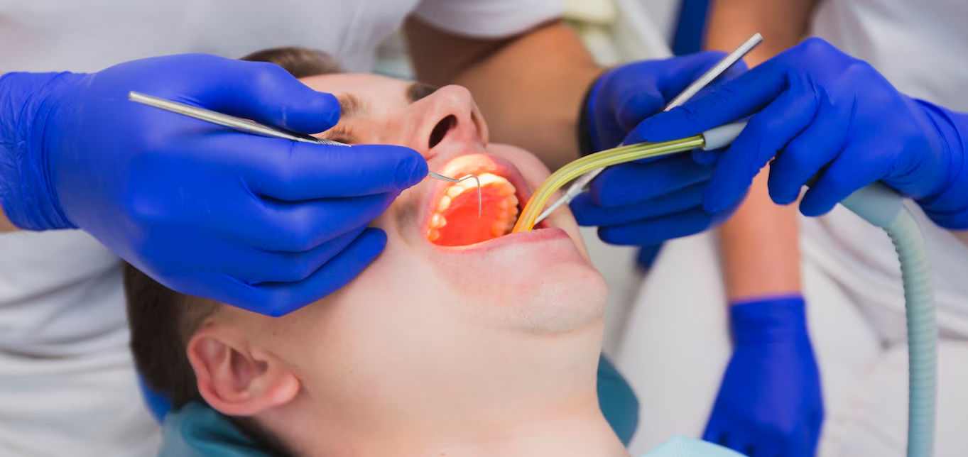 root-canal-or-tooth-extraction-which-is-the-better-choice