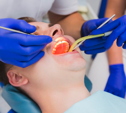 root-canal-or-tooth-extraction-which-is-the-better-choice