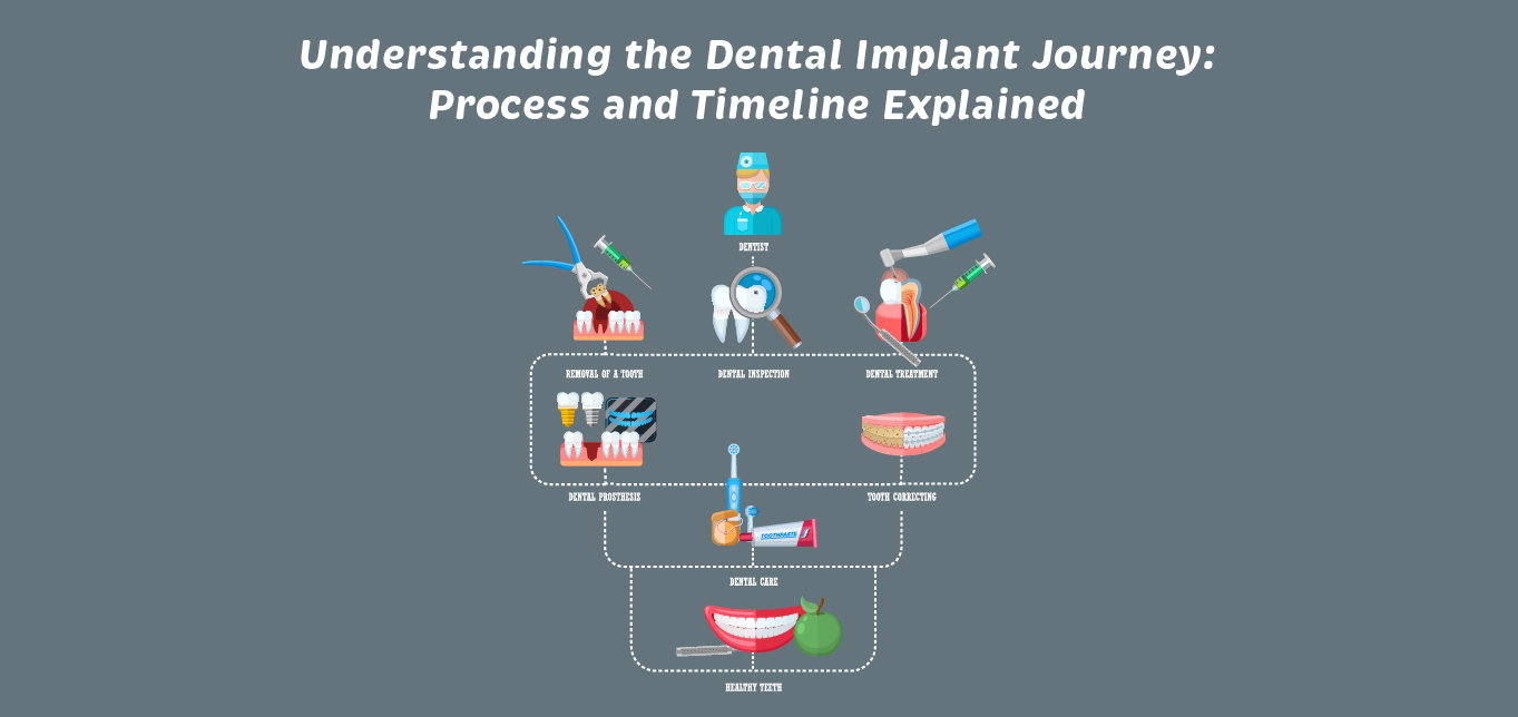 understanding-the-dental-implant-journey-process-and-timeline-explained