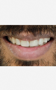 best cosmetic dentist in india